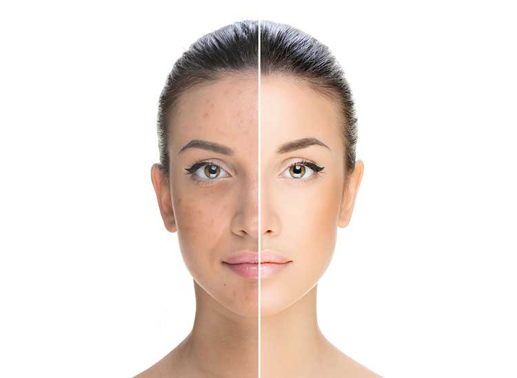 مراقبت از پوست